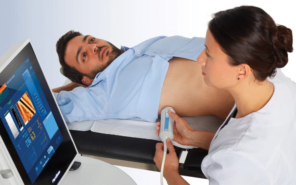 Fibroscan
